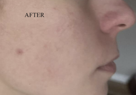 Customer review photo