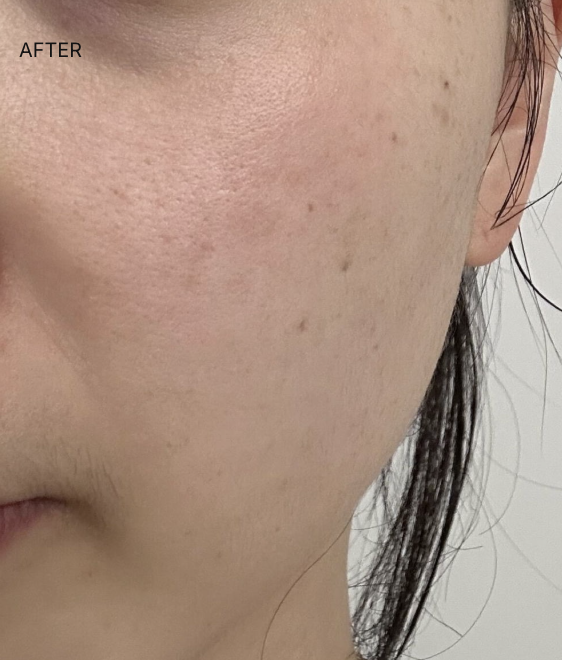 Customer review photo