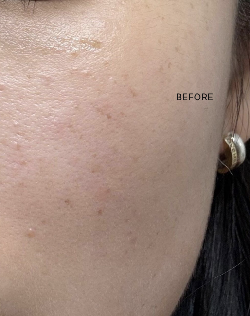 Customer review photo